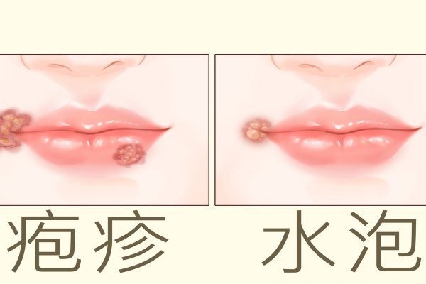 上火能吃羊肉吗