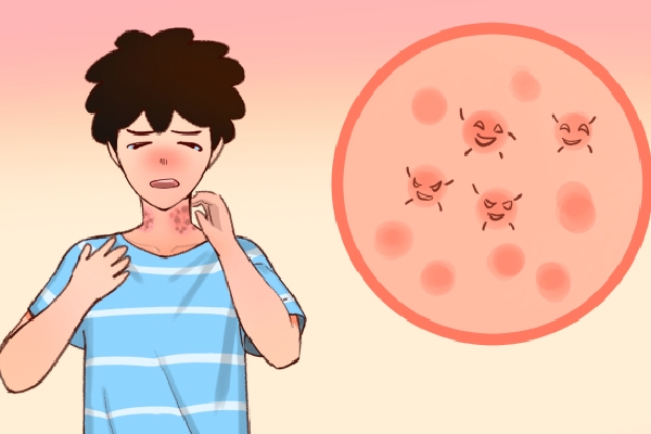 湿疹是什么引起的