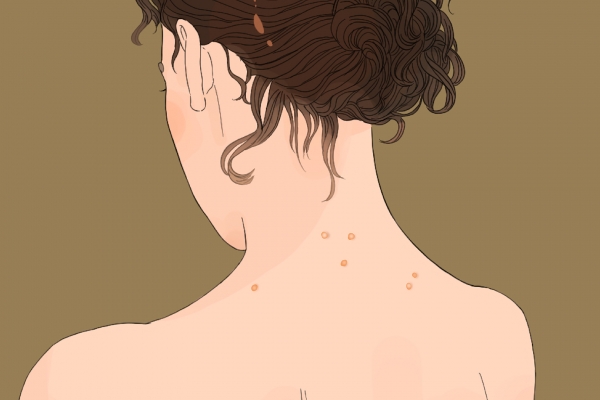 人湿气重有什么症状