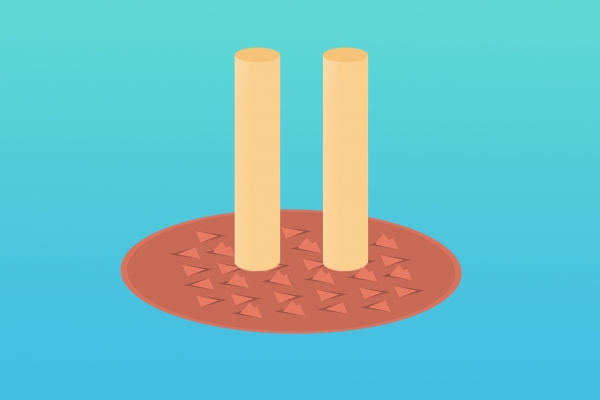 湿气重怎么排湿最有效