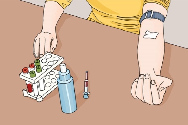 红细胞积压偏低是什么意思