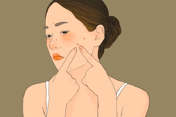 湿气重拔罐有用吗