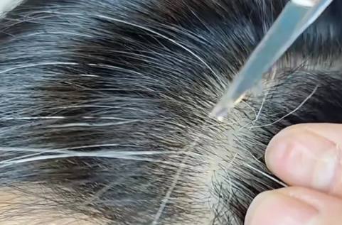 理发店的中药包白发有用吗1