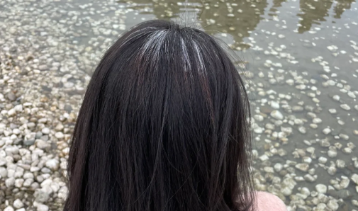 白头发看中医挂什么科1