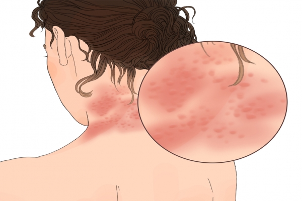 乳鸽的功效与作用、禁忌和食用方法