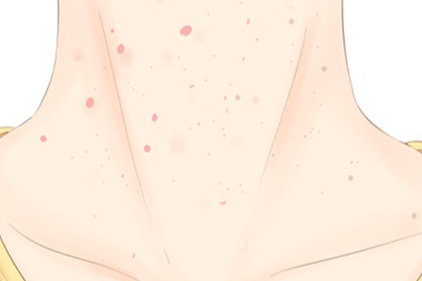 传染性软疣是性传播吗