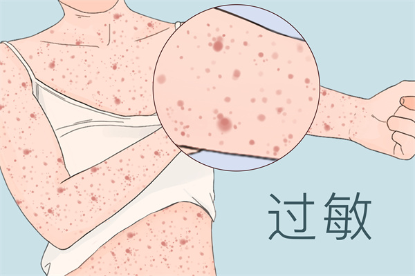 吃草莓会过敏吗