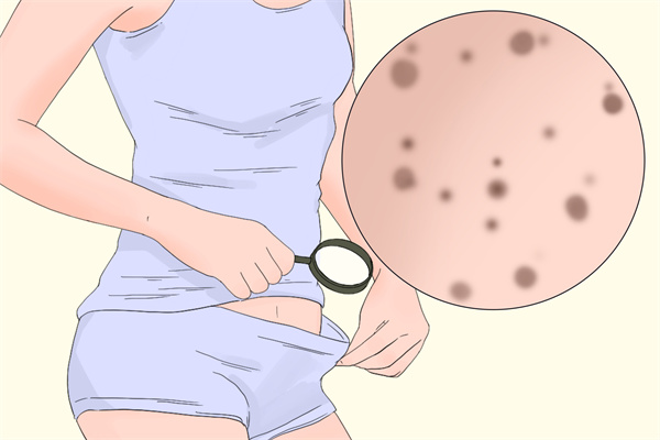 腹股沟在哪个位置