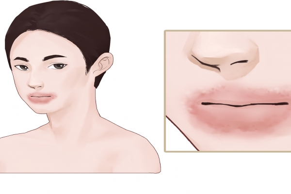 桑葚干可以直接吃吗