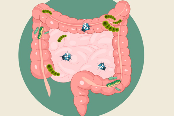 白头翁可以治肠溃疡吗