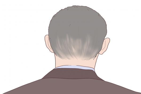 白头翁可以治疗头癣吗