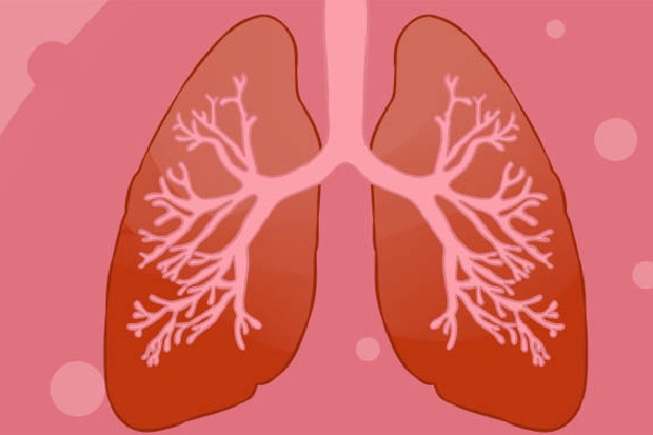 肺结核可能出现的症状包括哪些