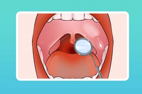 黑附片和黑顺片一样吗