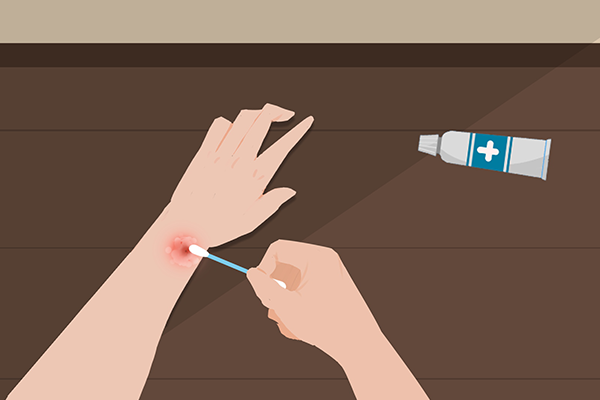 丹皮酚软膏的功效与作用