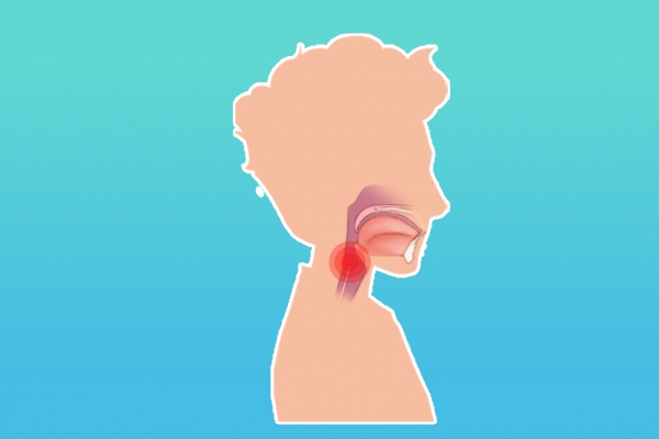 反流性食管炎有哪些症状