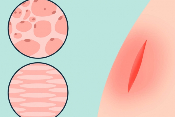 免疫力低下有哪些表现